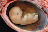 Ein menschlicher Embryo, etwa in der sechsten Schwangerschaftswoche. Foto: lunar caustic/creative commons/flickr