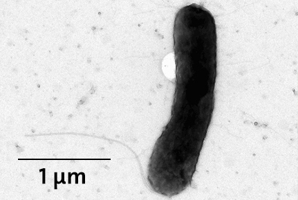 Mikroskopaufnahme eines Bakteriums. Foto: UHH/Perner