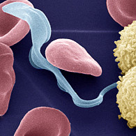 Kolorierte Elektronenmikroskopaufnahme des Parasiten Trypanosoma brucei (hellblau) im Blut, zusammen mit roten und weißen Blutkörperchen (Erythrozyten, rot, und Lymphozyten, weiß). Bild: Prof. Michael Duszenko, Universität Tübingen