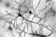 Der neurowissenschaftliche SFB 936 untersucht die Funktion von Netzwerken in gesunden und kranken Gehirnen. Bild: MethoxyRoxy