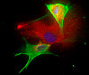 Leberzellen unter dem Mikroskop. Gefärbt sind die Zellkerne (blau), alpha-SMA (rot) als Zelltyp-spezifischer Marker und von den Zellen produziertes Bindegewebe (grün), Quelle: SFB 841