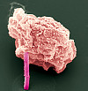 Elektronenmikroskopische Aufnahme einer Insektenzelle, aus der ein Proteinkristall (pink) herausragt. Bild: Michael Duszenko/Universität Tübingen
