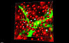 Der fluoreszierende Ausläufer (Dendrit) einer Nervenzelle (grün) ist umgeben von präsynaptischen Kontakten, die hier durch ein Computerprogramm rot markiert wurden. Potentielle Verbindungen (Synapsen) sind als silberne Kugeln dargestellt. Grafik: UKE 